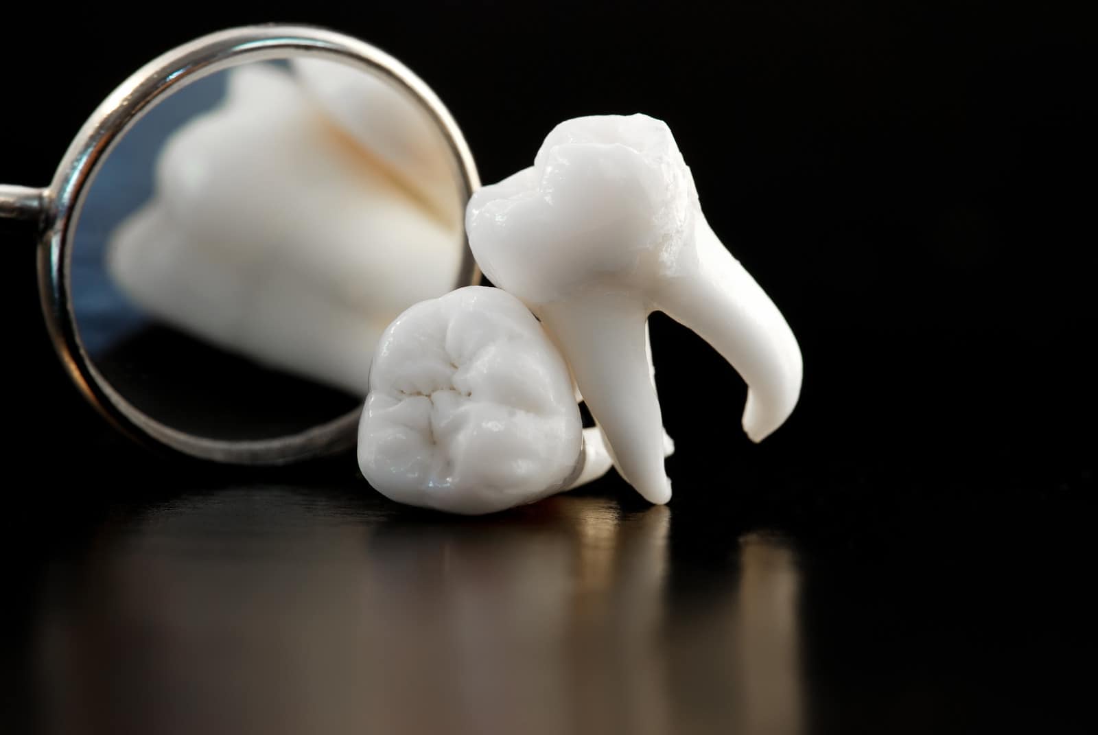 wisdom teeth extractions near kissimmee